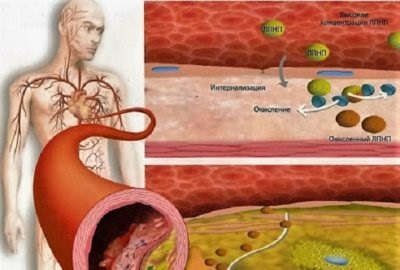 Oxidarea lipidelor în organism și rolul procesului