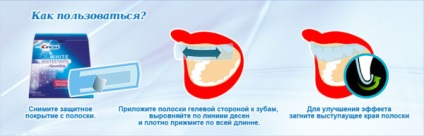 Відбілюючі засоби для зубів в аптеці який засіб вибрати для довготривалого ефекту