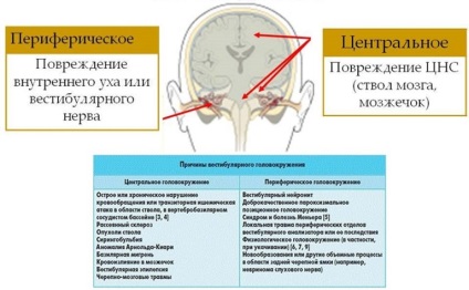 Abból, amit gyakran szédül női és férfi okai és kezelése vertigo