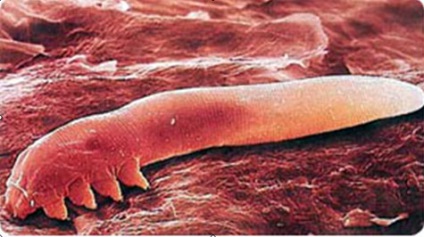 Szubkután atka Demodex (arc tick)