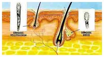 Demodexul acut subcutanat (acarianul facial)