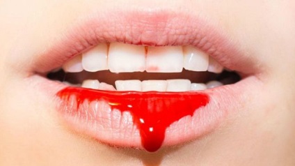 Gustul sângelui din gură provoacă femei și bărbați