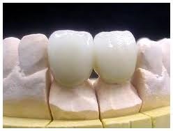 Protetica dentară