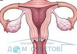 Reabilitarea după îndepărtarea trompelor uterine - răspunsuri și sfaturi privind întrebările dvs.