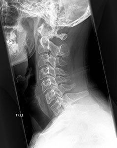 X-ray în timpul sarcinii pot face, consecințele