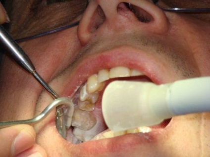 Family Dentistry közelében m Altufyevo mindenféle fogászati ​​szolgáltatások - kinevezések