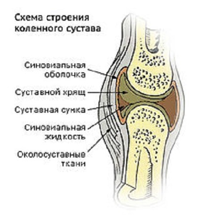 Synovita simptomelor articulare ale genunchiului și tratament