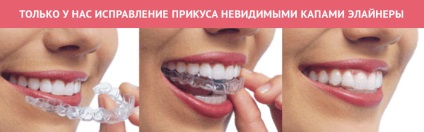 Fogászati ​​Vladimir - a legjobb fogászati ​​«a fogorvos fogászati»