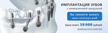 Fogászati ​​Vladimir - a legjobb fogászati ​​«a fogorvos fogászati»