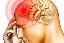 Temperatura la cursa cauzei cresterii, metodele de reducere a temperaturii cu accident vascular cerebral, on-line sanatos