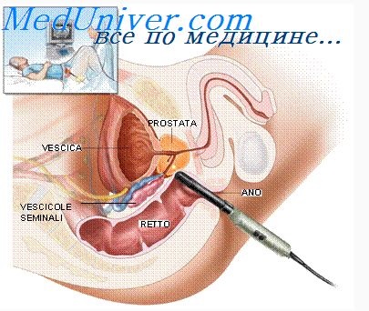 Tehnica chirurgicală pentru cancerul colorectal