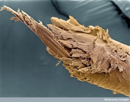 Țesuturi și organe ale unui om sub microscop