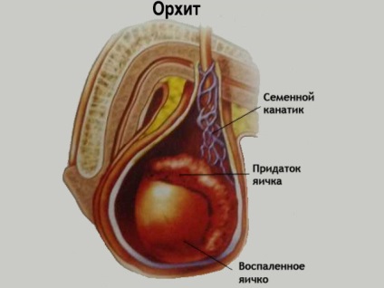 Efectuarea durerii în testicule pentru bărbați