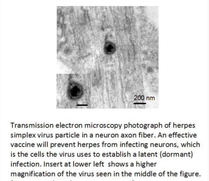 A tudósok hoztak létre egy új vakcina herpesz, hírek
