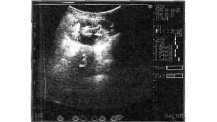 Diagnosticul ultrasonografic al obstrucției tractului urinar la animale mici