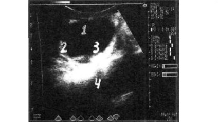 Diagnosticul ultrasonografic al obstrucției tractului urinar la animale mici