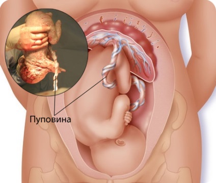 Intracranian traumatism la naștere - simptome ale bolii, prevenirea și tratamentul ancestral intracranian