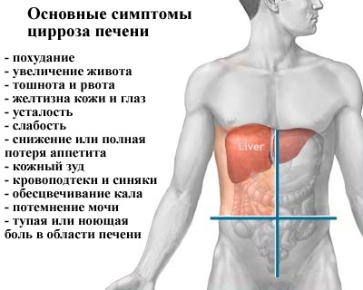 Simptomele bolii hepatice, diagnosticul și tratamentul ficatului