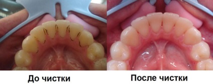 Dentare rațională, rău și metode de control și prevenire