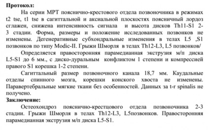 Durerea din spate doare, a făcut-o, la ce medic să se adreseze