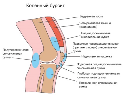 Bursitis a térd tünetek és a kezelés, a betegség okait