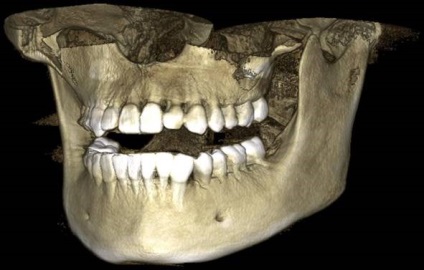 Ce arată gura maxilarului?