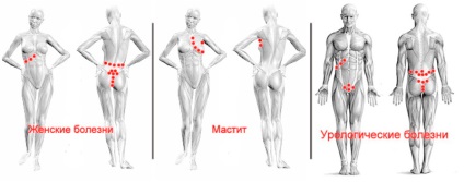 Hirudotherapy point leech sucking (scheme), versiune mobilă