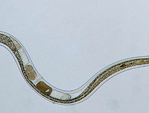 Worms Worms Viermi ai cauzei apariției, influenței asupra corpului, cum să trăim cu ei și cum să scăpăm