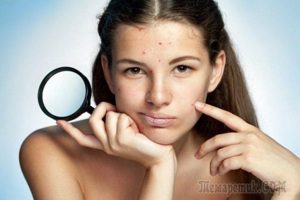 Hogyan lehet megszabadulni a kiütés a bőr az arcon