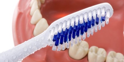 Cum să îngrijiți corect protezele dentare pentru a evita bolile