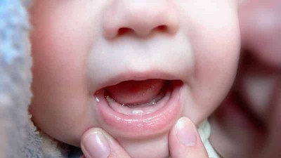 Tusea cu dentiție la copii cauzează ce trebuie să facă