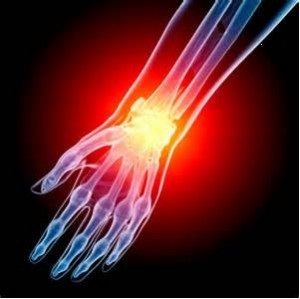 Creșterea tendonaginitei la încheietura mâinii - manifestări și tratament