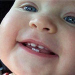 Dinții copilului sunt zdrobiți în cauzele principale și în tratamentul necesar
