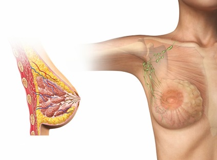Mamografia sau ultrasunetele glandei mamare