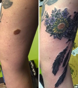 Pot să fac tatuaje pe semnele de naștere ale tatuajelor cu semne de naștere