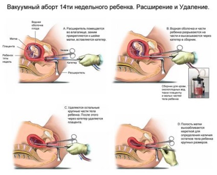 Tudok tampont elveszíteni szüzességét lehet használni szüzek tamponok, a hetedik