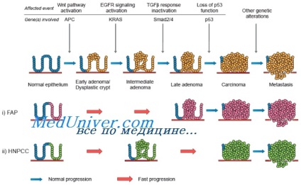 Ereditar non-polipoză cancer de colon (NNPT, sindrom Lynch i