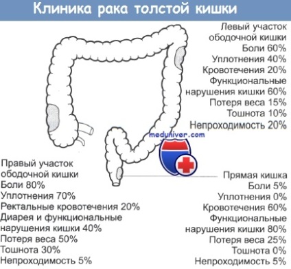 Örökletes nonpolyposis kolorektális rák (nnprtk Lynch szindróma i