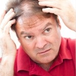 Căderea părului la bărbați cauze și tipuri