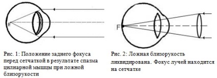 Instructor optic Zenica