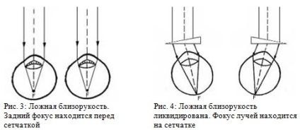 Instructor optic Zenica