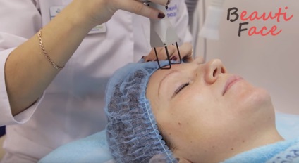 Peelingul pe față în principalele tipuri de salon și etapele procedurii de întinerire - capriciu feminin