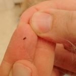 Metode dovedite de purici în subsol și apartament, modalități de a elimina insectele de la subsol