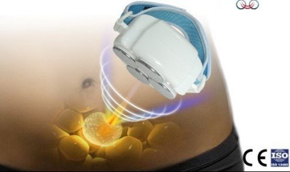 Cavitația cu ultrasunete din indicațiile și contraindicațiile celulitei, înainte și după fotografii, video