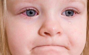 Inflama ochii copilului - ce sa faca