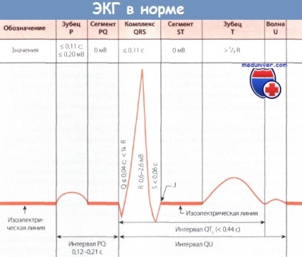 A fogak az elektrokardiogram