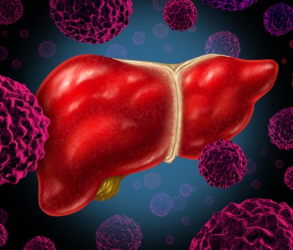 15 Fapte despre hepatita trebuie sa stii
