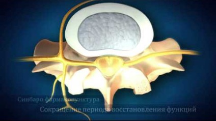 Acupunctura - acupunctura, metode netraditionale de tratament, chasen