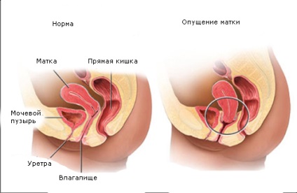 Simptomele, simptomele, diagnosticul și tratamentul hiperanteselor