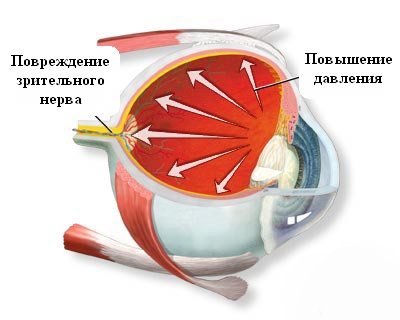 Glaucomul la câini - tratament cu metode eficiente în clinica noastră